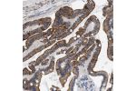 Immunohistochemical staining of human duodenum shows strong cytoplasmic and membranous positivity in glandular cells.