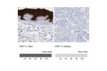 Immunohistochemistry analysis in human skin and kidney tissues using Anti-KRT1 antibody. Corresponding KRT1 RNA-seq data are presented for the same tissues.
