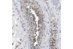 Immunohistochemical staining of human testis shows moderate cytoplasmic positivity in cells in seminiferous ducts.