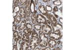 Immunohistochemical staining of human kidney shows strong cytoplasmic positivity in cells in tubules.