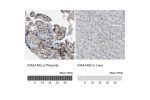 Immunohistochemistry analysis in human placenta and liver tissues using HPA017956 antibody. Corresponding KIAA1462 RNA-seq data are presented for the same tissues.