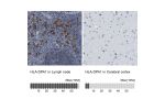Immunohistochemistry analysis in human lymph node and cerebral cortex tissues using Anti-HLA-DPA1 antibody. Corresponding HLA-DPA1 RNA-seq data are presented for the same tissues.