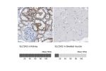 Immunohistochemistry analysis in human kidney and skeletal muscle tissues using HPA017980 antibody. Corresponding SLC3A2 RNA-seq data are presented for the same tissues.