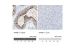 Immunohistochemistry analysis in human testis and liver tissues using HPA017984 antibody. Corresponding SPAM1 RNA-seq data are presented for the same tissues.