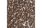 Immunohistochemical staining of human liver shows strong cytoplasmic positivity in hepatocytes.