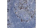 Immunohistochemical staining of human tonsil shows strong cytoplasmic positivity in germinal center cells.