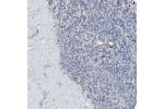 Immunohistochemical staining of human ovary shows weak cytoplasmic positivity in ovarian stroma cells.