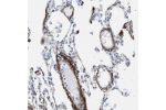 Immunohistochemical staining of human lung shows moderate to strong positivity in blood vessels.