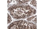 Immunohistochemical staining of human testis shows strong cytoplasmic positivity in cells in seminiferous ducts.