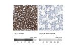 Immunohistochemistry analysis in human liver and bone marrow tissues using HPA018139 antibody. Corresponding GOT2 RNA-seq data are presented for the same tissues.