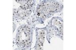 Immunohistochemical staining of human colon shows strong nuclear, cytoplasmic and membranous positivity in glandular cells.