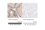 Immunohistochemistry analysis in human thyroid gland and skeletal muscle tissues using HPA018156 antibody. Corresponding CTSB RNA-seq data are presented for the same tissues.