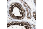 Immunohistochemical staining of human testis shows moderate to strong cytoplasmic positivity in cells in seminiferous ducts.