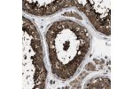 Immunohistochemical staining of human hippocampus shows strong cytoplasmic and dot like nucleolar positivity in neuronal cells and strong cytoplasmic staining in glial cells.