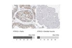 Immunohistochemistry analysis in human testis and skeletal muscle tissues using HPA018295 antibody. Corresponding ATXN2 RNA-seq data are presented for the same tissues.