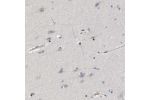 Immunohistochemical staining of human cerebral cortex shows moderate nuclear positivity in a subset of glial cells.