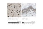 Immunohistochemistry analysis in human cerebral cortex and skin tissues using HPA018304 antibody. Corresponding G3BP2 RNA-seq data are presented for the same tissues.