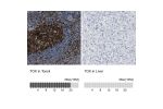 Immunohistochemistry analysis in human tonsil and liver tissues using HPA018322 antibody. Corresponding TOX RNA-seq data are presented for the same tissues.