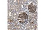 Immunohistochemical staining of human kidney shows strong membranous and cytoplasmic positivity in cells in glomeruli.