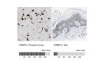 Immunohistochemistry analysis in human cerebral cortex and skin tissues using HPA018425 antibody. Corresponding G3BP2 RNA-seq data are presented for the same tissues.