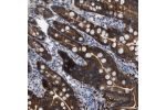 Immunohistochemical staining of human duodenum shows strong positivity in glandular cells.