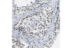 Immunohistochemical staining of human placenta shows strong nuclear membrane positivity in trophoblastic cells.