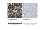 Immunohistochemistry analysis in human stomach and liver tissues using HPA018446 antibody. Corresponding CLDN18 RNA-seq data are presented for the same tissues.