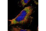Immunofluorescent staining of human cell line U-251 MG shows localization to vesicles.