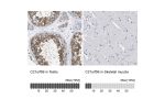 Immunohistochemistry analysis in human testis and skeletal muscle tissues using Anti-C21orf59 antibody. Corresponding C21orf59 RNA-seq data are presented for the same tissues.