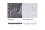 Immunohistochemistry analysis in human lymph node and cerebral cortex tissues using Anti-IL16 antibody. Corresponding IL16 RNA-seq data are presented for the same tissues.