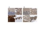Immunohistochemical staining of human cerebellum, prostate, skeletal muscle and skin using Anti-BAG3 antibody HPA018493 (A) shows similar protein distribution across tissues to independent antibody HPA020586 (B).