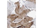 Immunohistochemical staining of human stomach shows moderate cytoplasmic positivity in glandular cells.