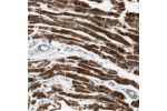 Immunohistochemical staining of human heart muscle shows strong cytoplasmic positivity in myocytes.
