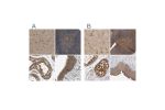 Immunohistochemical staining of human cerebral cortex, lymph node, testis and urinary bladder using Anti-CCT8 antibody HPA018520 (A) shows similar protein distribution across tissues to independent antibody HPA029426 (B).