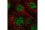Immunofluorescent staining of human cell line A-431 shows localization to nucleoplasm.