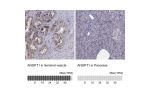 Immunohistochemistry analysis in human seminal vesicle and pancreas tissues using Anti-ANGPT1 antibody. Corresponding ANGPT1 RNA-seq data are presented for the same tissues.
