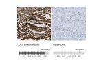 Immunohistochemistry analysis in human heart muscle and liver tissues using HPA018803 antibody. Corresponding DES RNA-seq data are presented for the same tissues.
