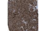 Immunohistochemical staining of human pancreas shows strong membranous positivity in exocrine glandular cells.