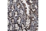 Immunohistochemical staining of human rectum shows strong cytoplasmic positivity in glandular cells.