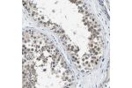Immunohistochemical staining of human testis shows weak cytoplasmic positivity in cells in seminiferous ducts.