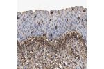 Immunohistochemical staining of human urinary bladder shows moderate cytoplasmic positivity.