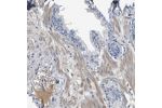 Immunohistochemical staining of human prostate shows distinct positivity in plasma.