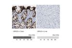 Immunohistochemistry analysis in human colon and liver tissues using HPA018858 antibody. Corresponding GPA33 RNA-seq data are presented for the same tissues.
