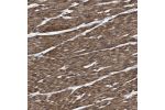 Immunohistochemical staining of human smooth muscle shows distinct cytoplasmic positivity in smooth muscle cells.