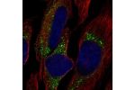 Immunofluorescent staining of human cell line HeLa shows localization to endoplasmic reticulum & vesicles.