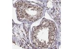 Immunohistochemical staining of human testis shows moderate to strong nuclear positivity in cells in seminiferous ducts.