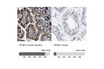 Immunohistochemistry analysis in human small intestine and testis tissues using HPA018884 antibody. Corresponding P4HB RNA-seq data are presented for the same tissues.