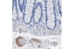 Immunohistochemical staining of human colon shows moderate to strong positivity in plasma in blood vessels.