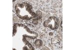 Immunohistochemical staining of human prostate shows moderate to strong membranous positivity in glandular cells.