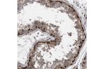 Immunohistochemical staining of human testis shows strong nuclear positivity in cells in seminiferous ducts.
